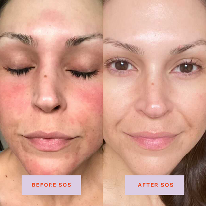 Travel SOS Rescue Spray